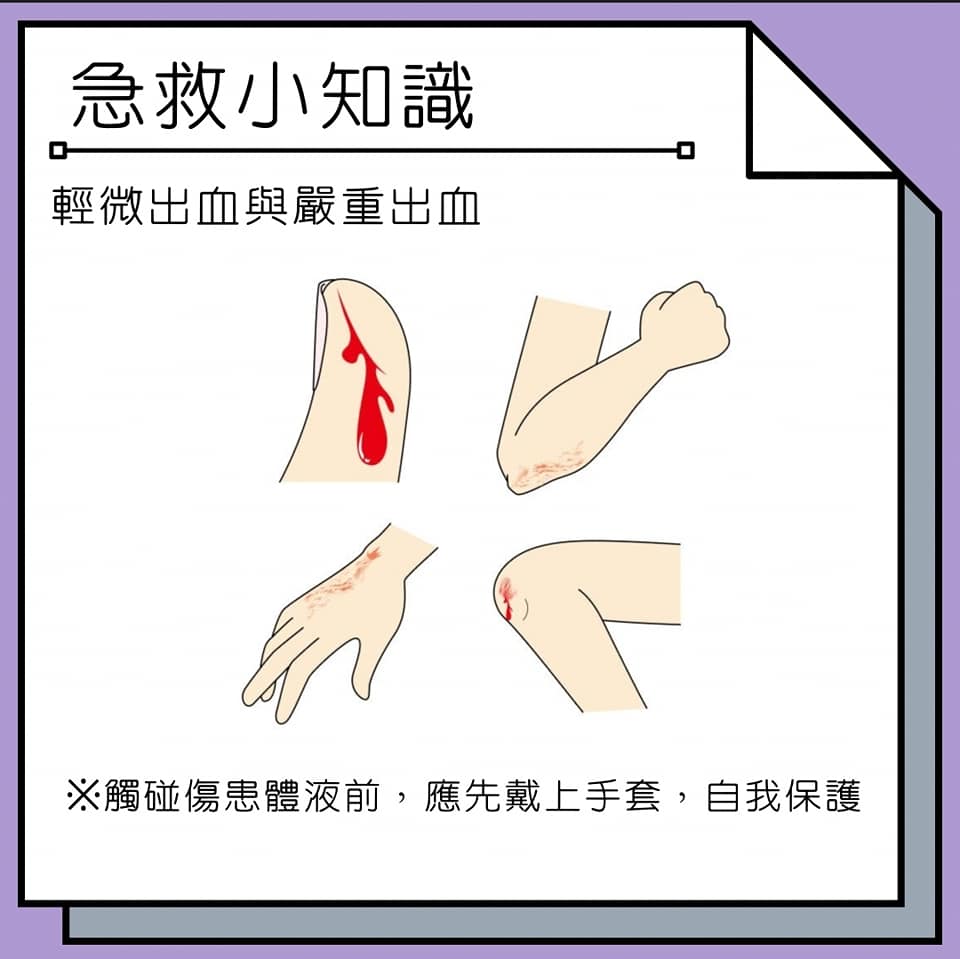 中大急救社 FAC - 【急救小知識－創傷part-2】...