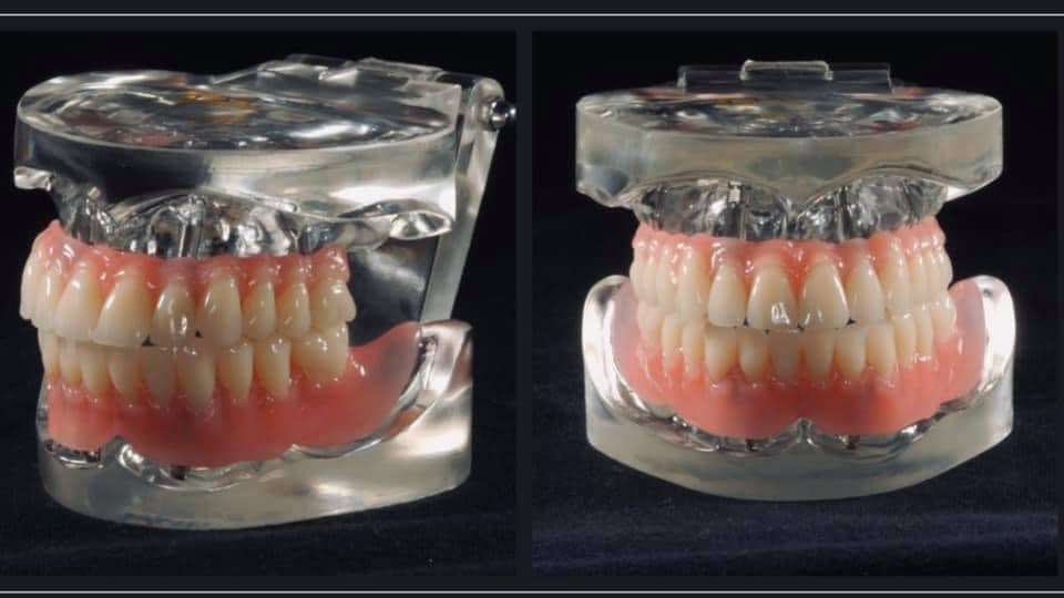 The new Ot Bridge system... - Rhein83 Attachments | Facebook