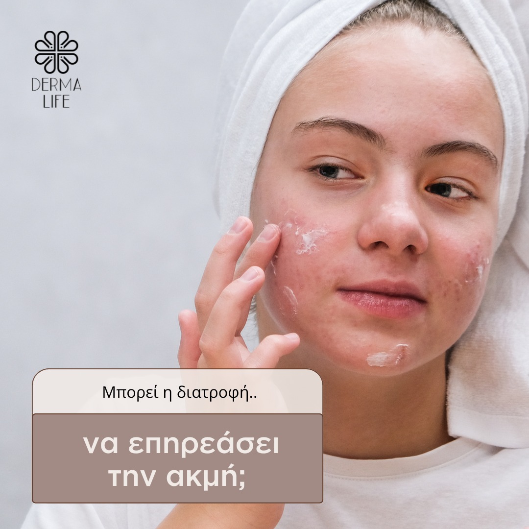 DermaLife - 💡𝐃𝐞𝐫𝐦𝐚 𝐋𝐢𝐟𝐞 𝐐&𝐀 Μπορεί η διατροφή να...