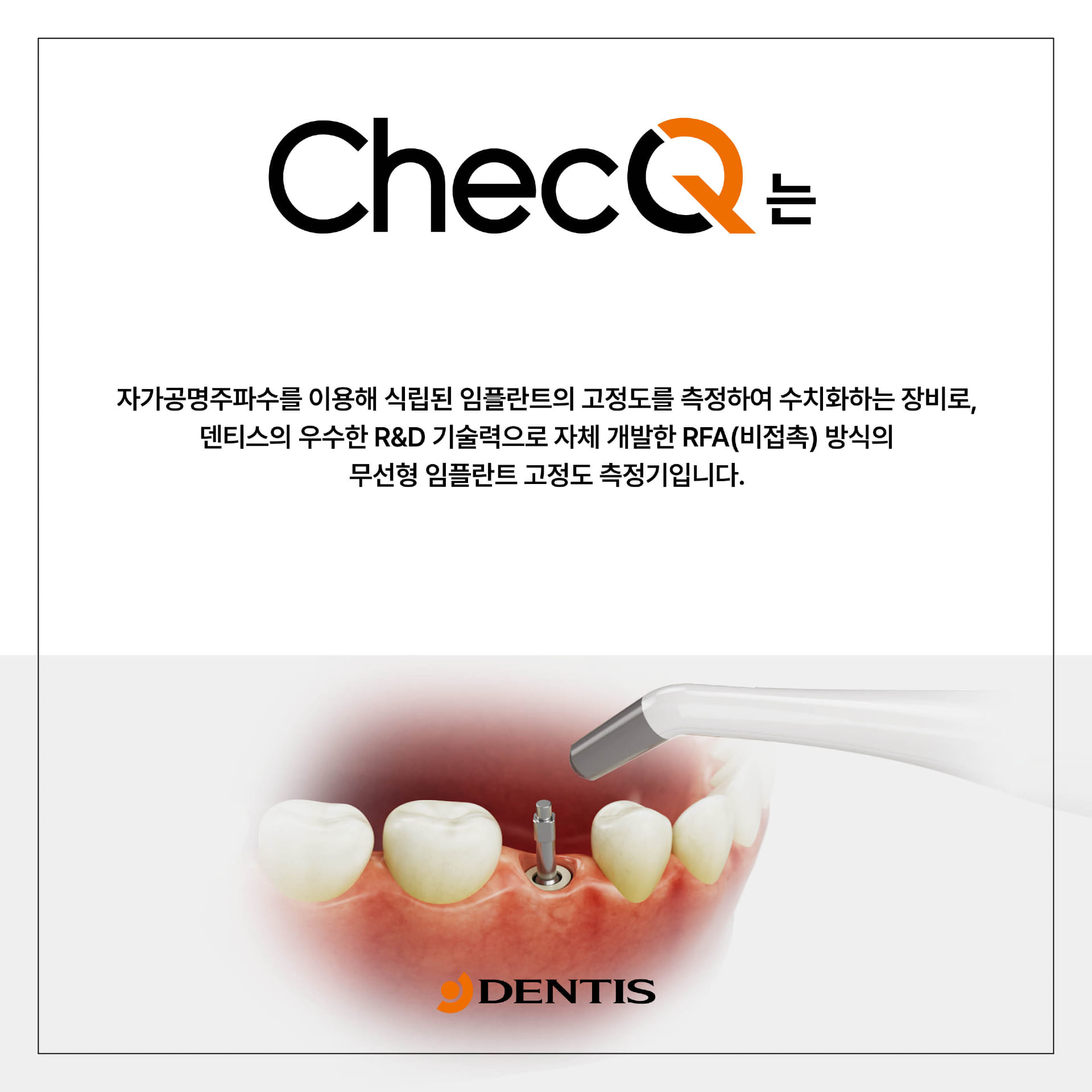 DENTIS Implant - 🎉덴티스 임플란트 고정도 측정기 ‘ChecQ' 출시 임박!🎉 임플란트...