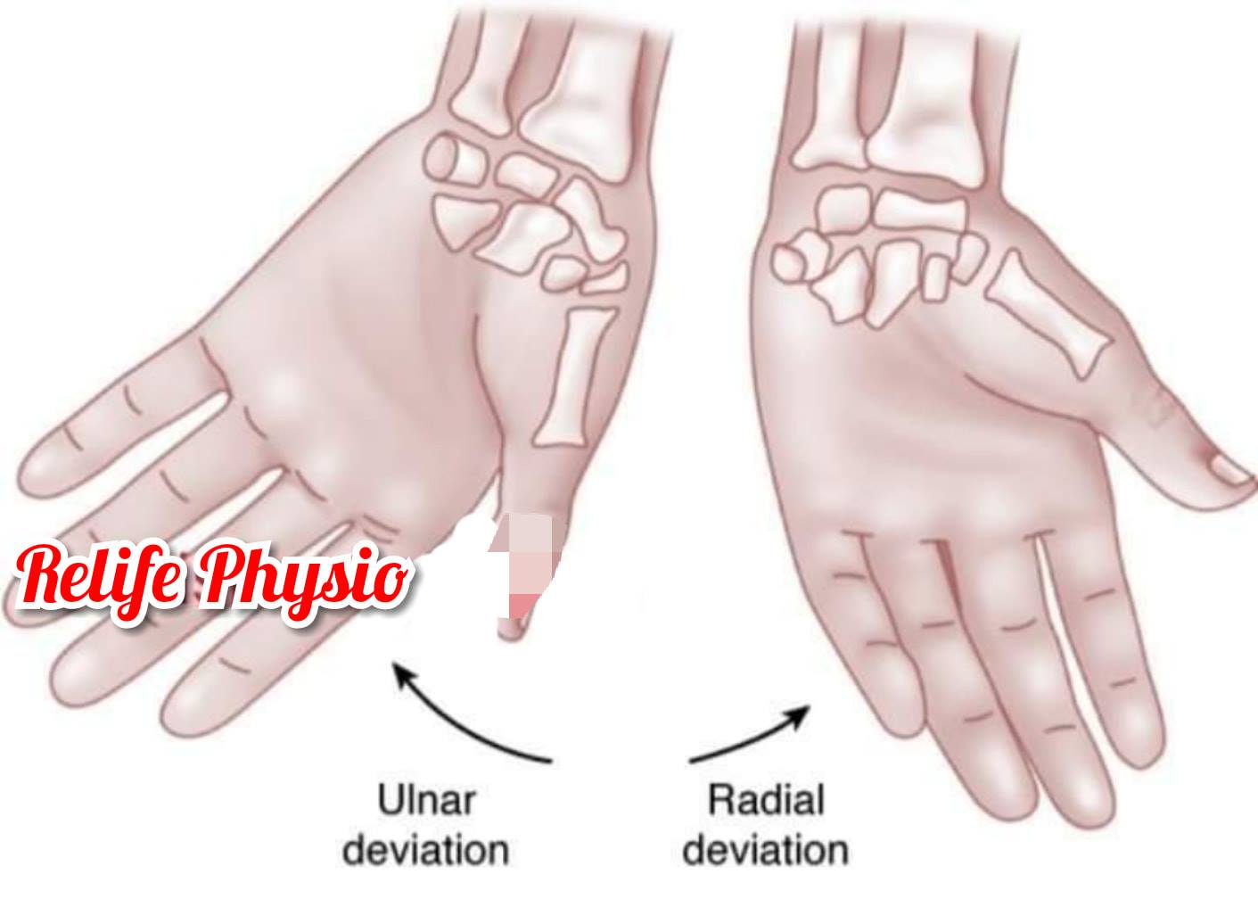 Relife Physio - The Forearm,Wrist and Hand Complex stretching
