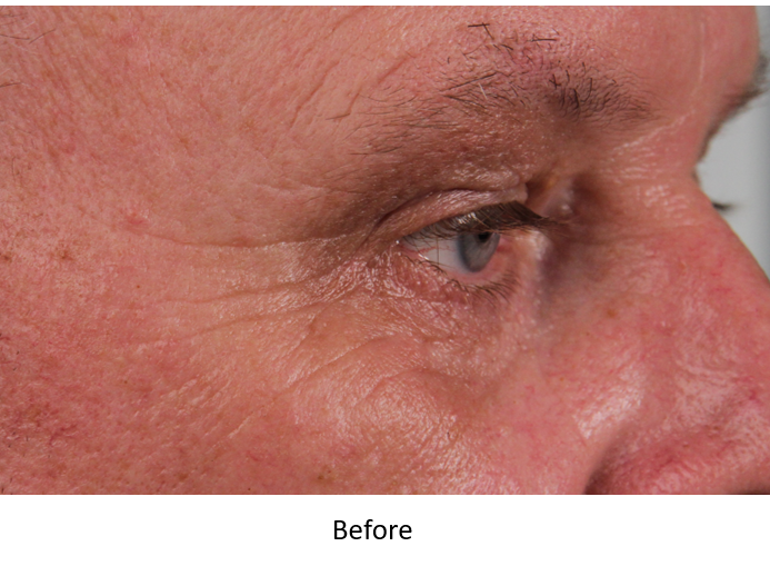 Costec - Check out this soft belph with NEOGEN. . How... | Facebook