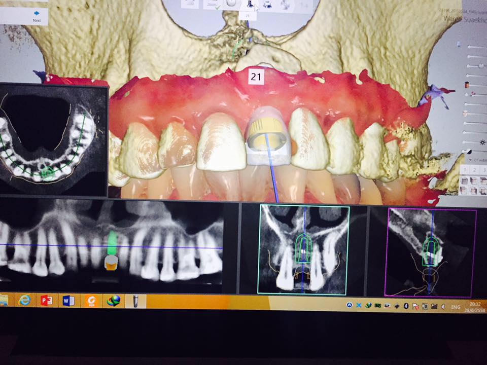 ATTA Dental Lab - ATTA Dental Lab updated their cover photo.