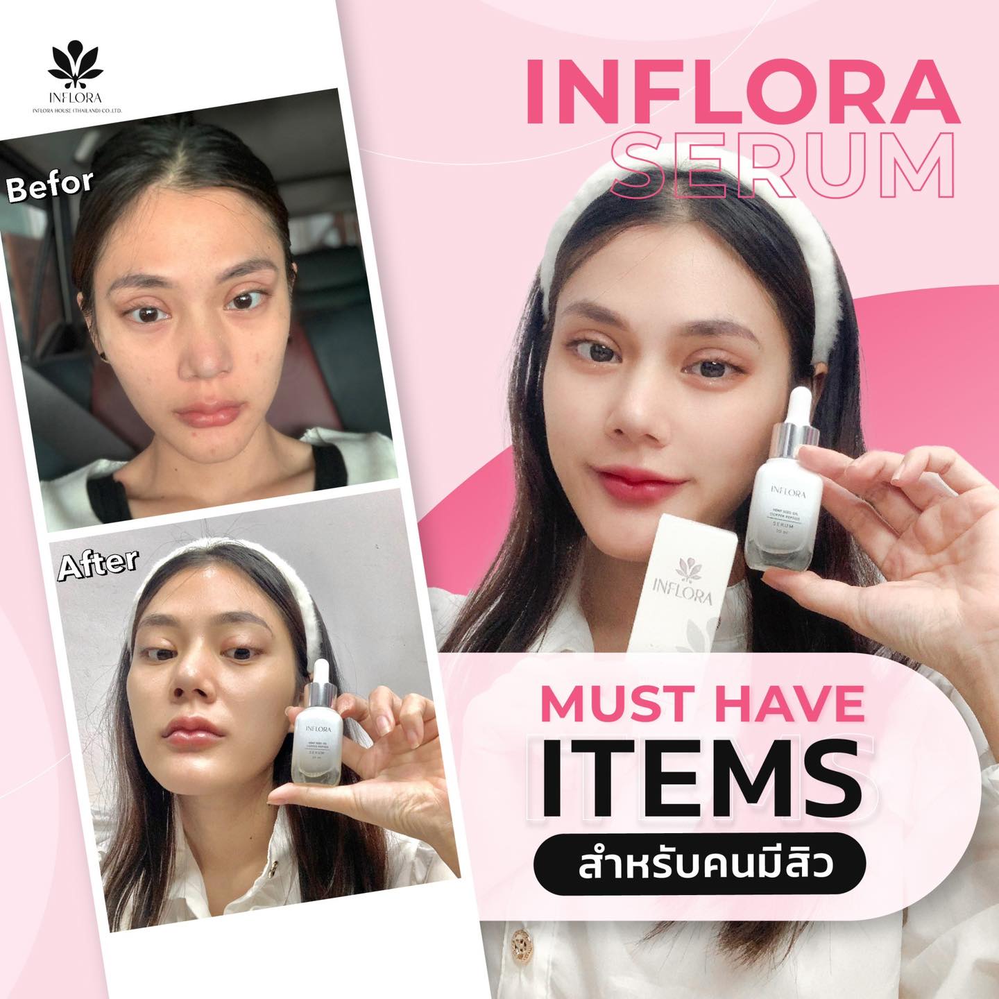 Inflora เซรั่มปราบสิว สูตรคลินิก