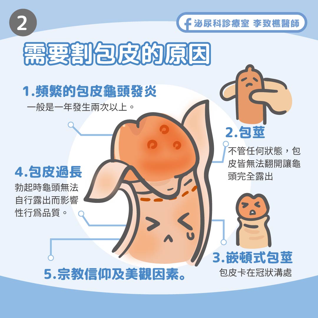 泌尿科診療室 李致樵醫師 - 🔪什麼時候要下刀?包皮一定要割嗎?...