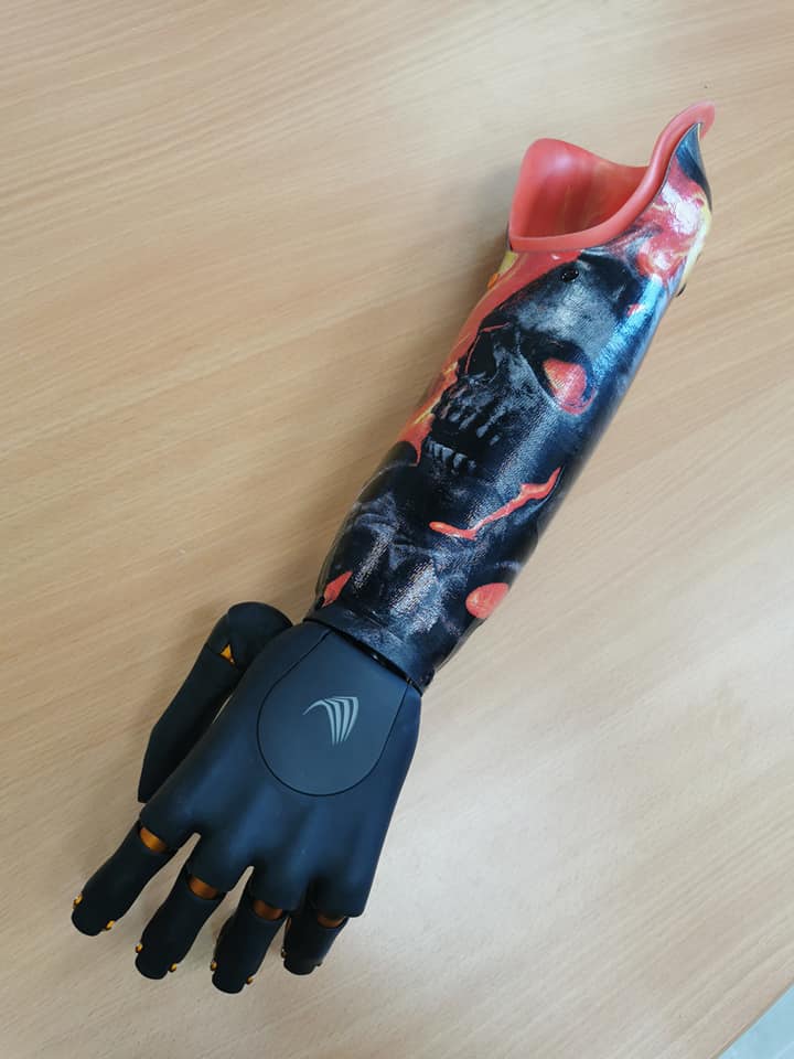 Ortho Form Armprothetik added a... - Ortho Form Armprothetik