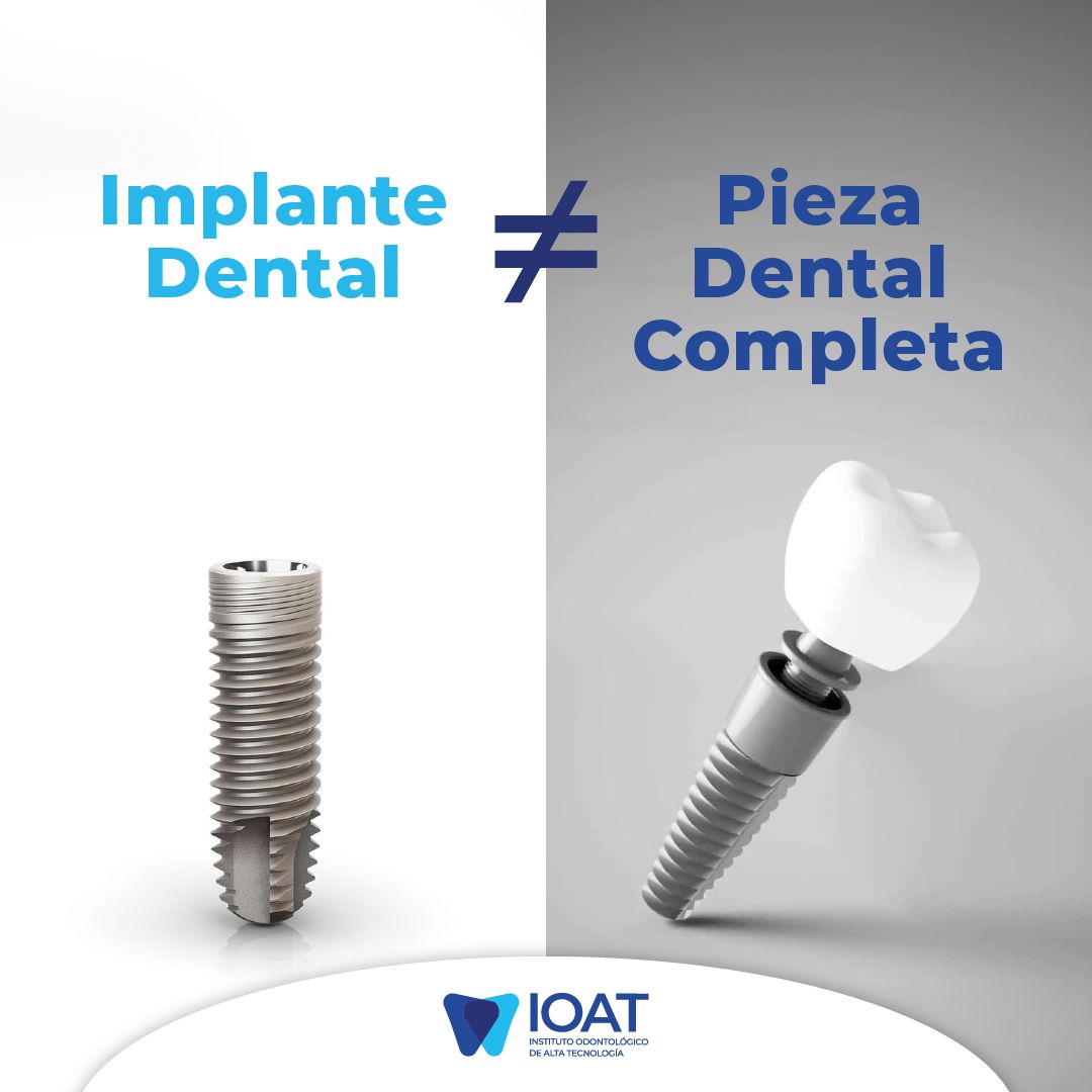 ¿Cuáles... - IOAT - Instituto Odontológico de Alta Tecnología | Facebook