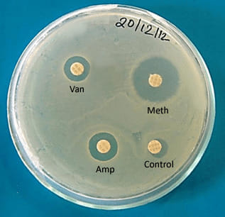 Microbiologie - Disc diffusion method showing antibiotic susceptibility ...