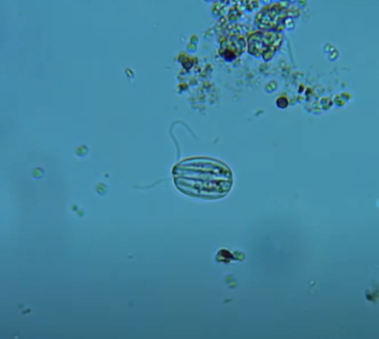 Las - This is a flagellate. They have 1 or 2 flagella (string like arms ...