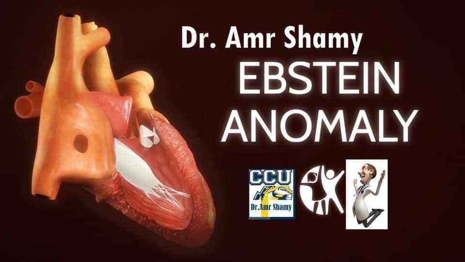 CCU - 🙇What is Ebstein’s Anomaly⁉️ #CCU_ANOMALY...