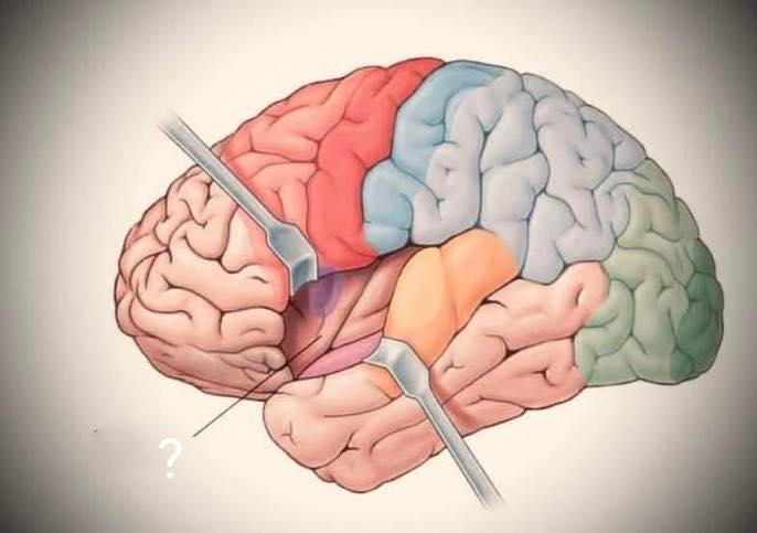 OpenNeurons - ฮั่นแน่ … lobe อะไร เฉลย Insular lobe เมื่อแหวกออกมา ก็ ...
