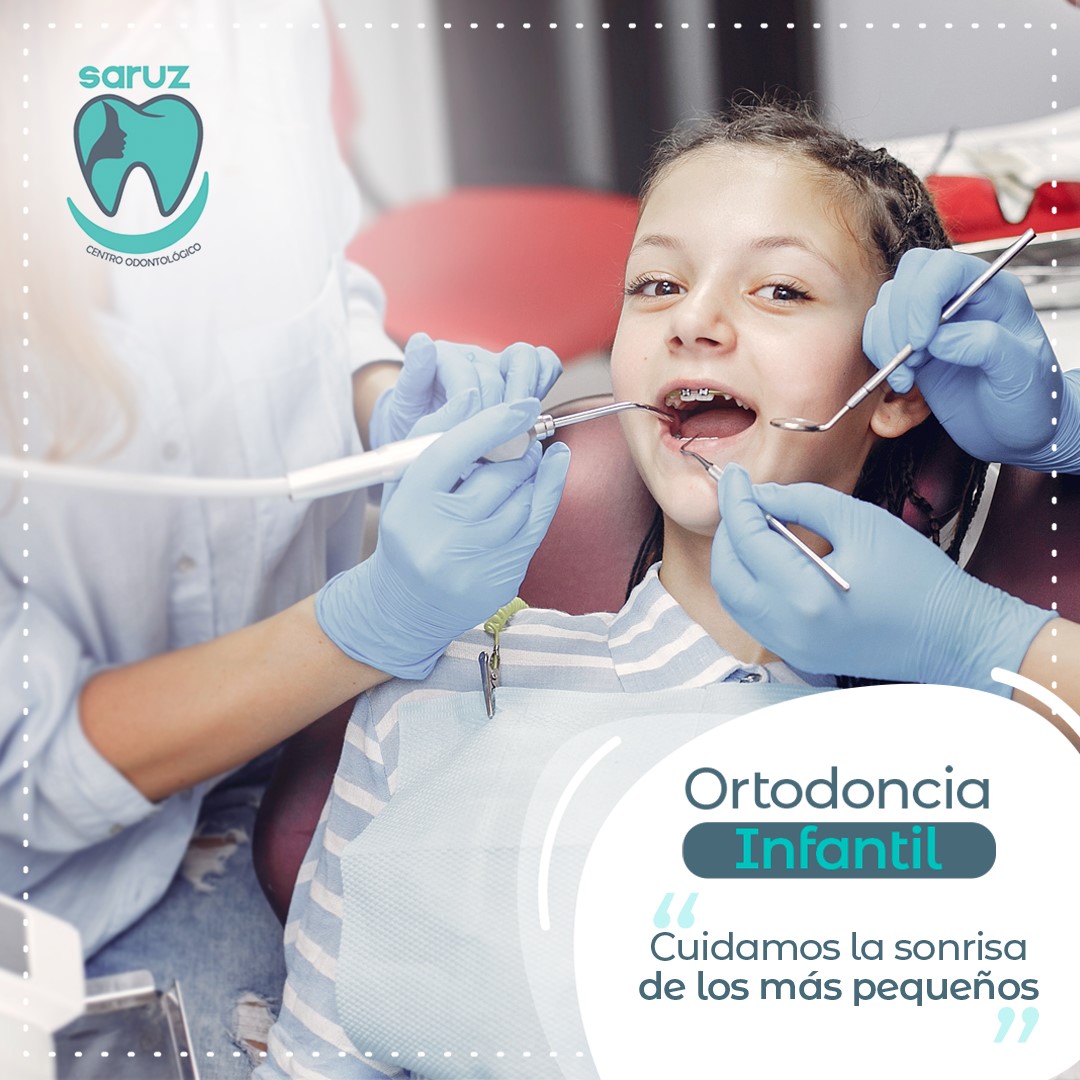 LA ORTODONCIA EN LOS... - Centro Odontológico SARUZ | Facebook