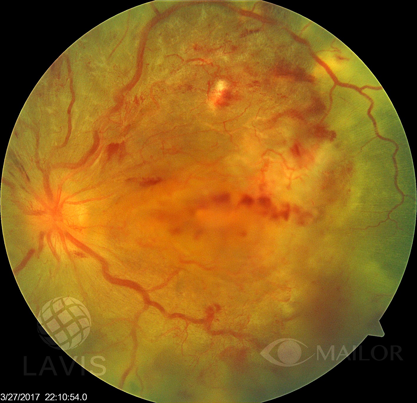 Mailor / Mexican Advanced Imaging Laboratory For Ocular Research ...
