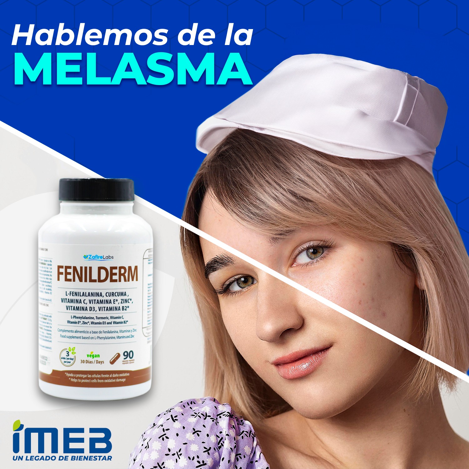 Imeb.hn - Fenilderm cuida tu piel 📩Para más información:... | Facebook