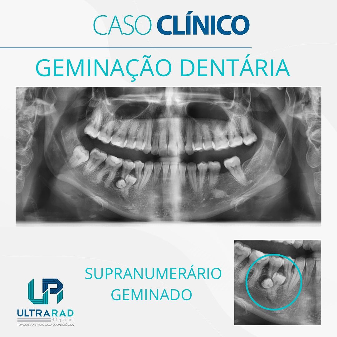🔷O caso... - Ultrarad - Radiologia Odontológica Digital | Facebook