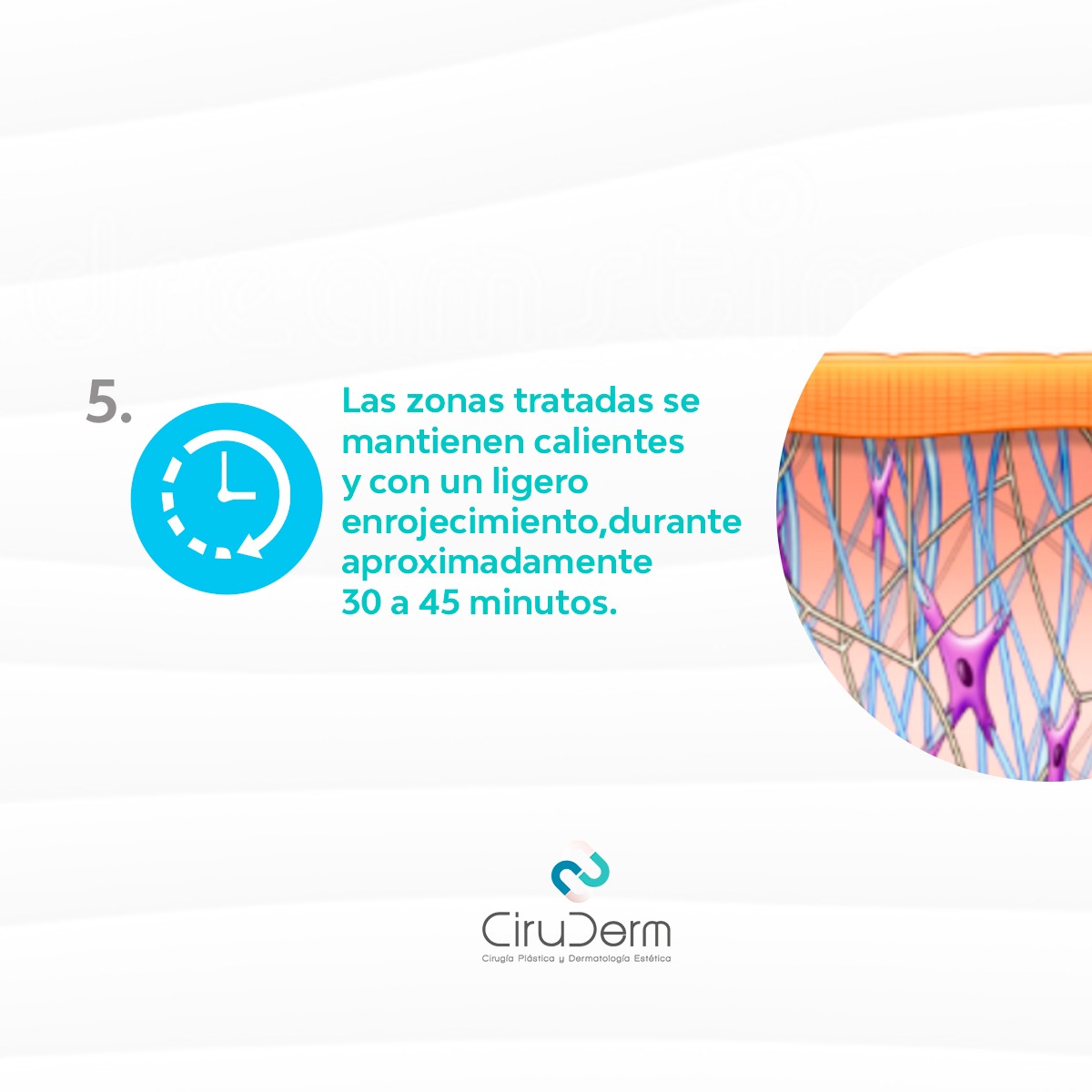 Ciruderm - Conoce cual es el proceso que aplicamos para el...