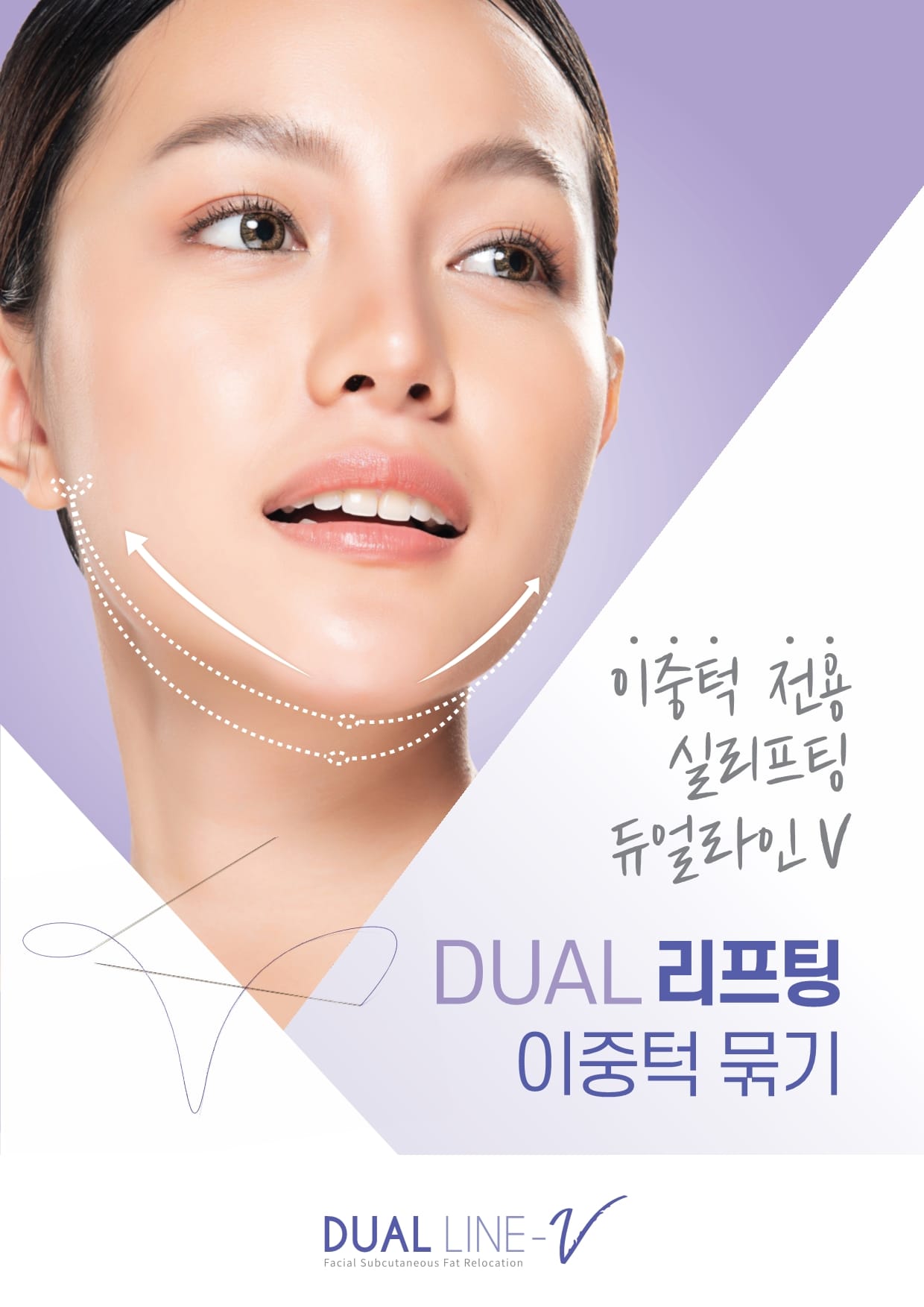 듀얼라인-브이 Dualline-V 실리프팅 added a... - 듀얼라인-브이 Dualline-V 실리프팅