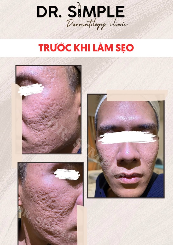 Dr. Simple - 𝗗𝗮 𝗯𝗮̣𝗻 𝘀𝗲̃ 𝗻𝗵𝘂̛ 𝘁𝗵𝗲̂́ 𝗻𝗮̀𝗼 𝘁𝗿𝗼𝗻𝗴 𝟳 𝗻𝗴𝗮̀𝘆... | Facebook