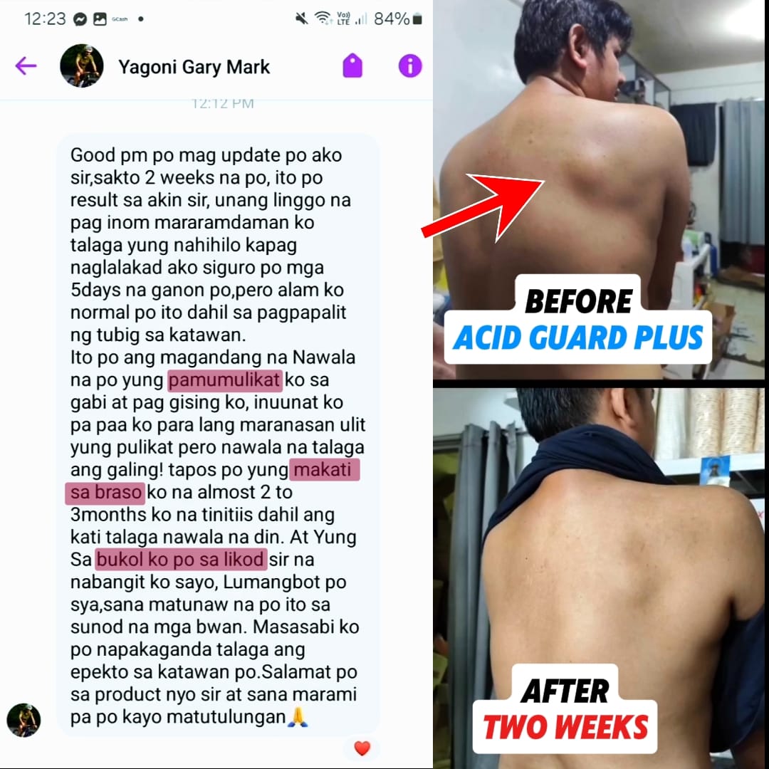 Acid Guard Plus Bulacan | Guiguinto