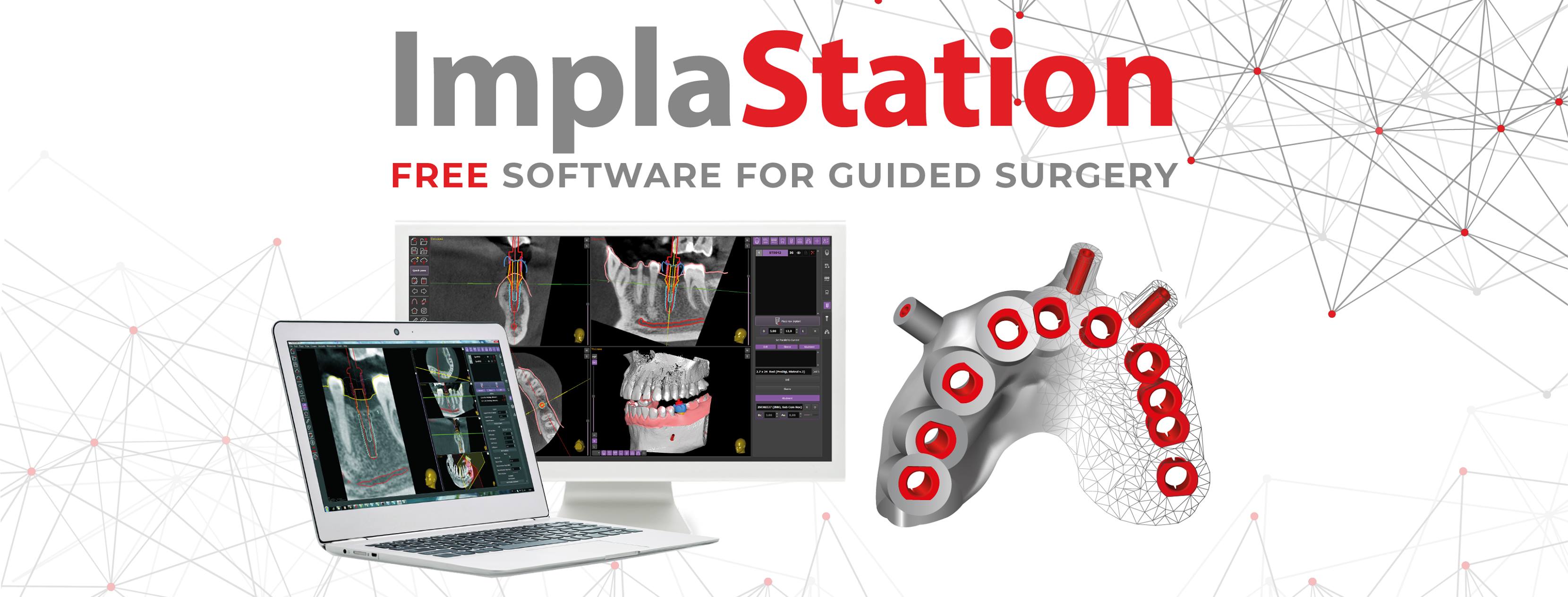 ImplaStation