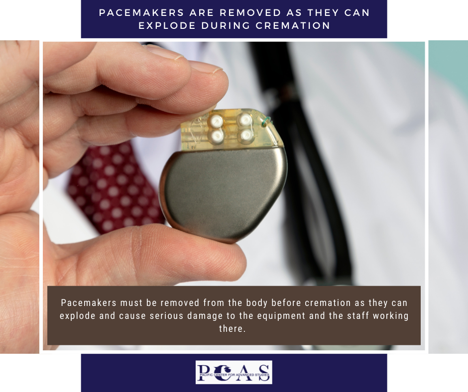 PCAS - Do you know? #WednesdayTrivia Pacemakers are removed as they can ...