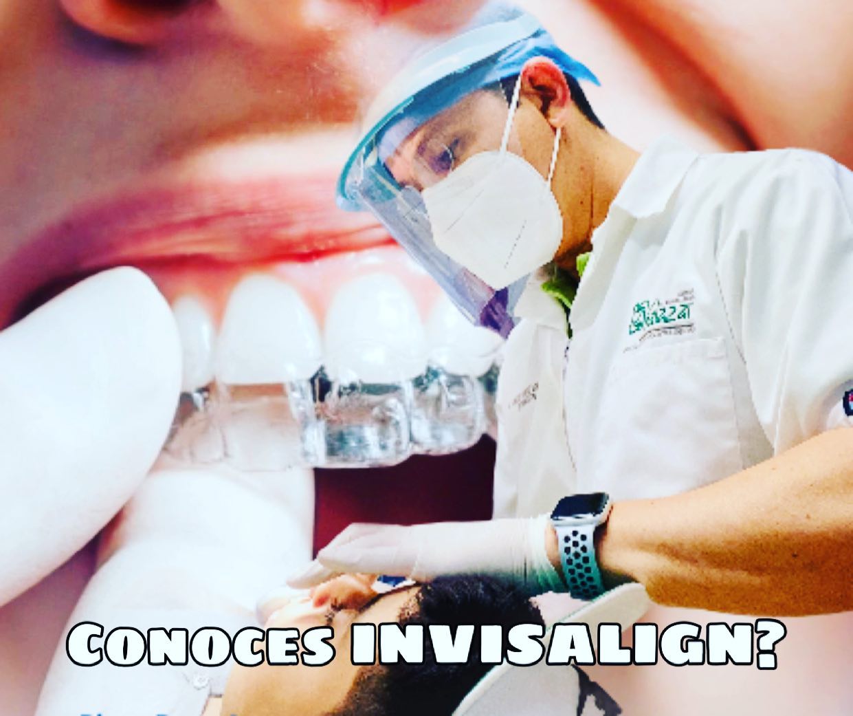 SABES QUE ES INVISALIGN?... - Dr Salazar Tu Ortodoncista