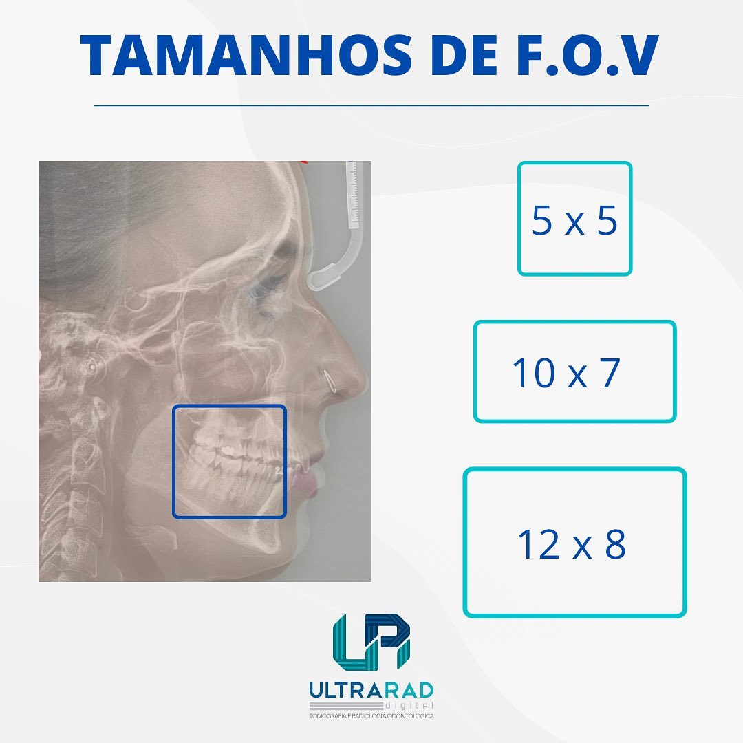 🔷 Parâmetro... - Ultrarad - Radiologia Odontológica Digital