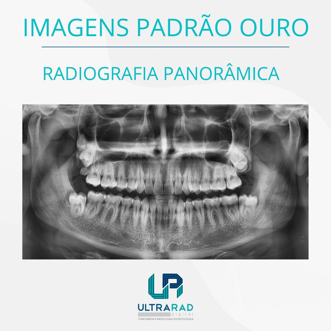 🦷 Seu... - Ultrarad - Radiologia Odontológica Digital | Facebook