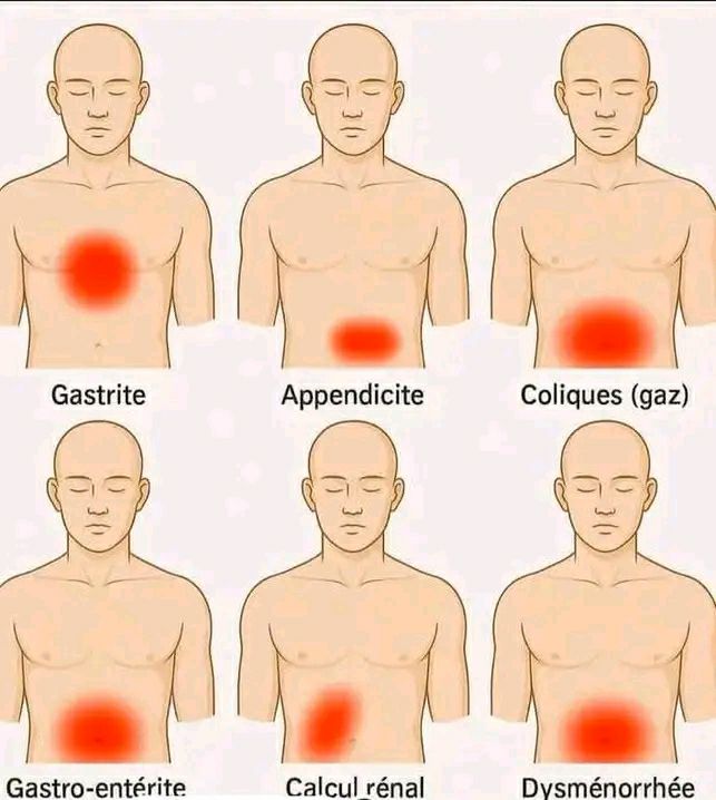 josu-localisation-des-douleurs-abdominales-et-causes-possibles-1