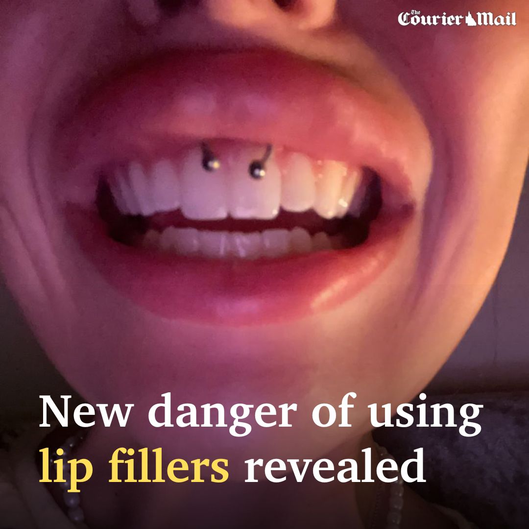 Courier Mail - Women obsessed with the perfect pout could...