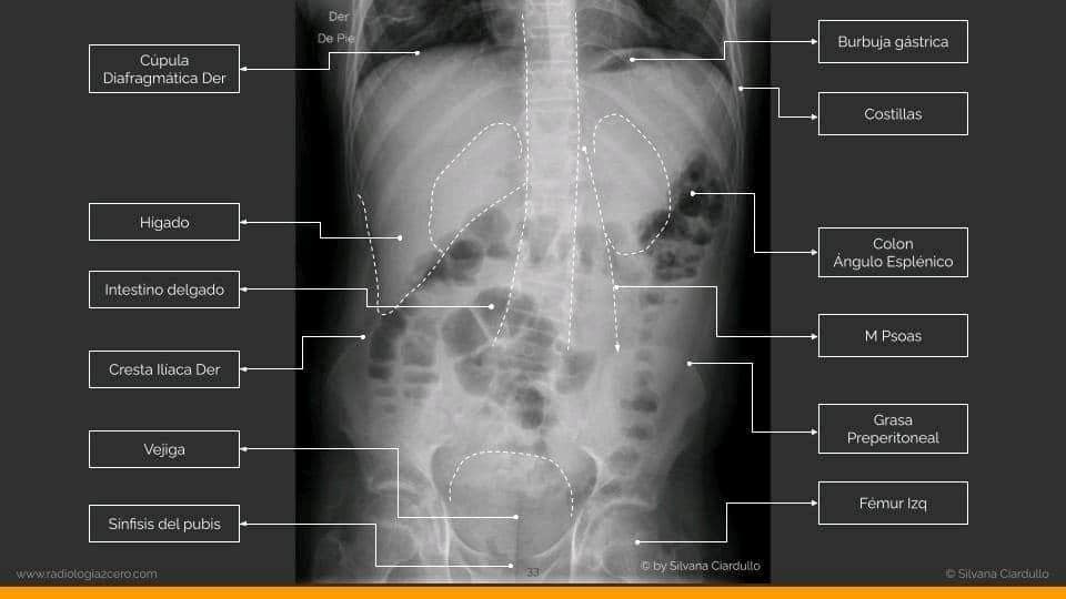 Radiologia Club - Anatomía humana en la Radiografía...