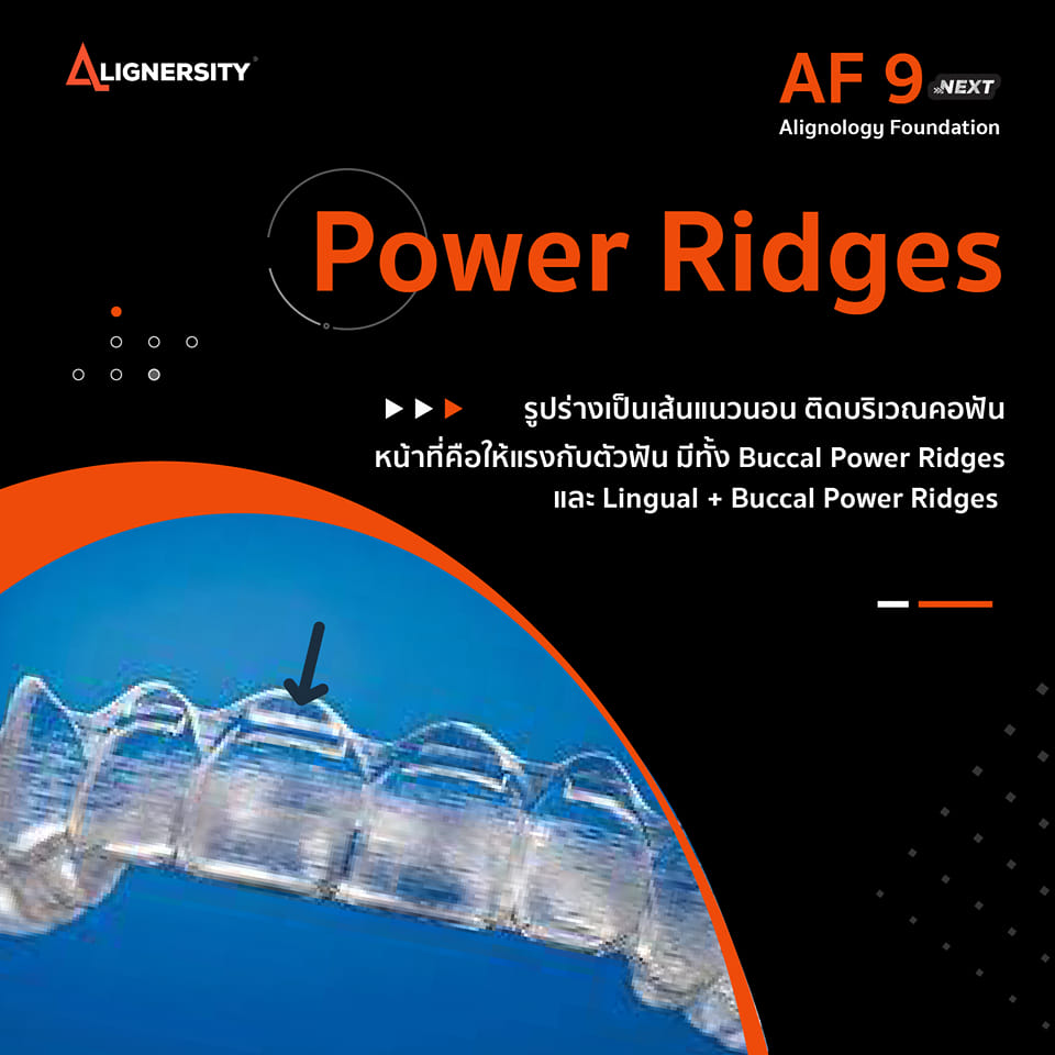 Alignersity - 👉Power Ridges👈... | Facebook