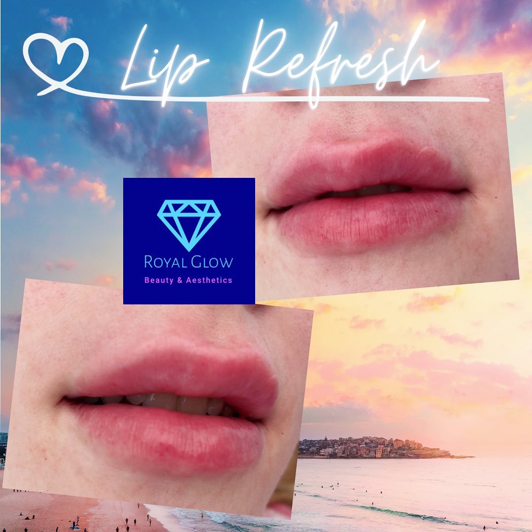 Royal Glow Aesthetics | Littlehampton