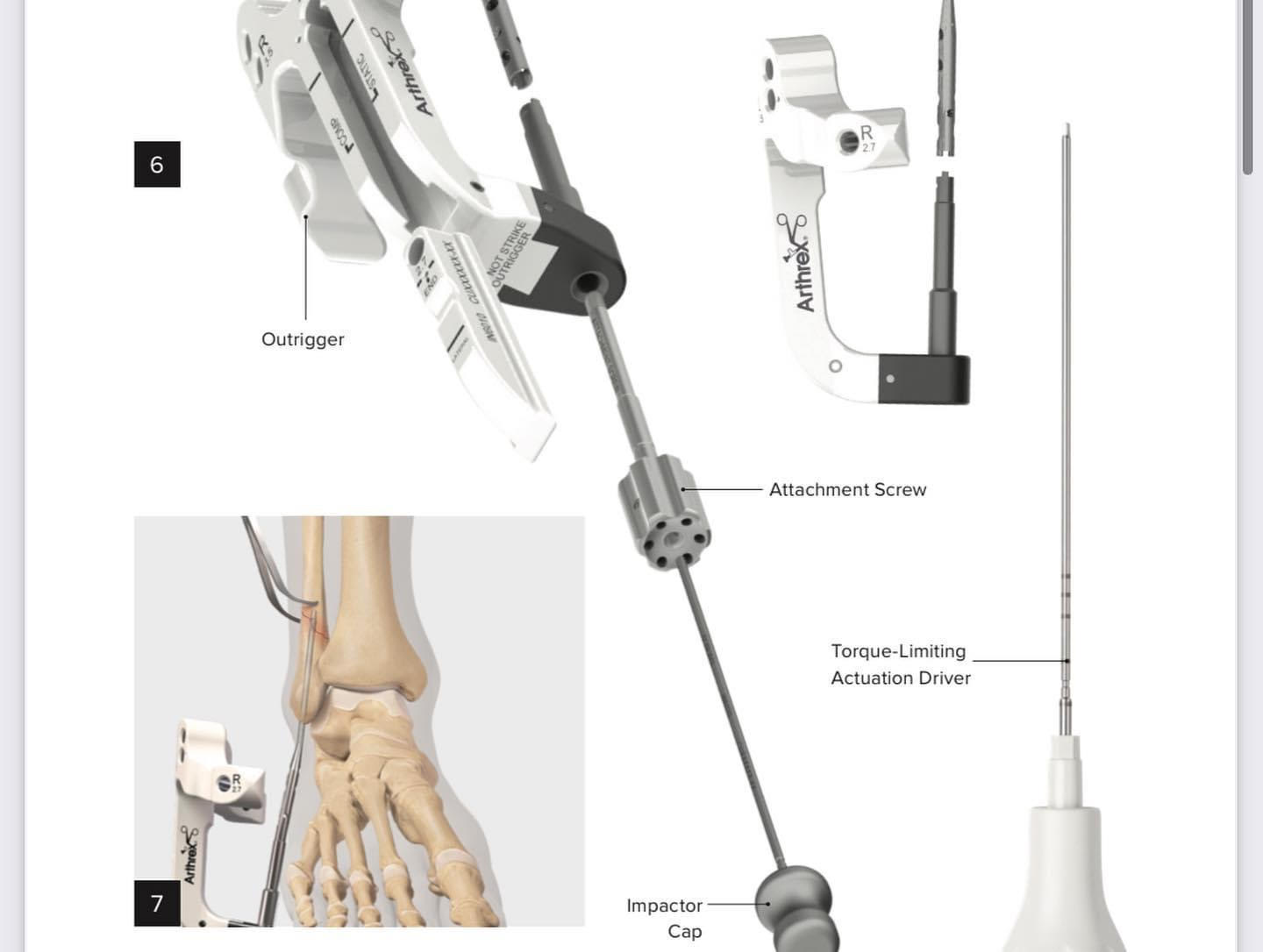 What does the incision look like... - Orthopedics New England