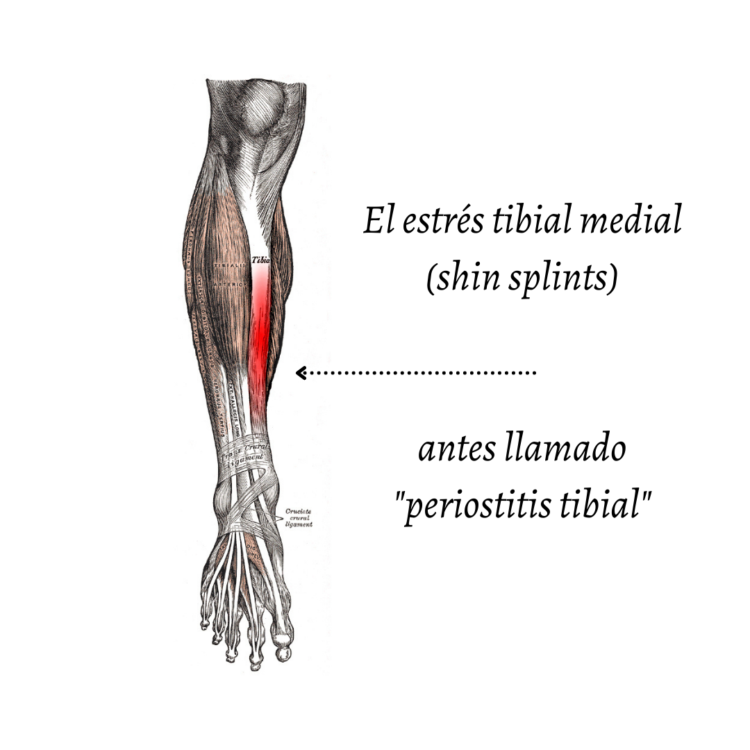 Grupo de Estudios de Osteopatía - El síndrome de estrés tibial medial ...