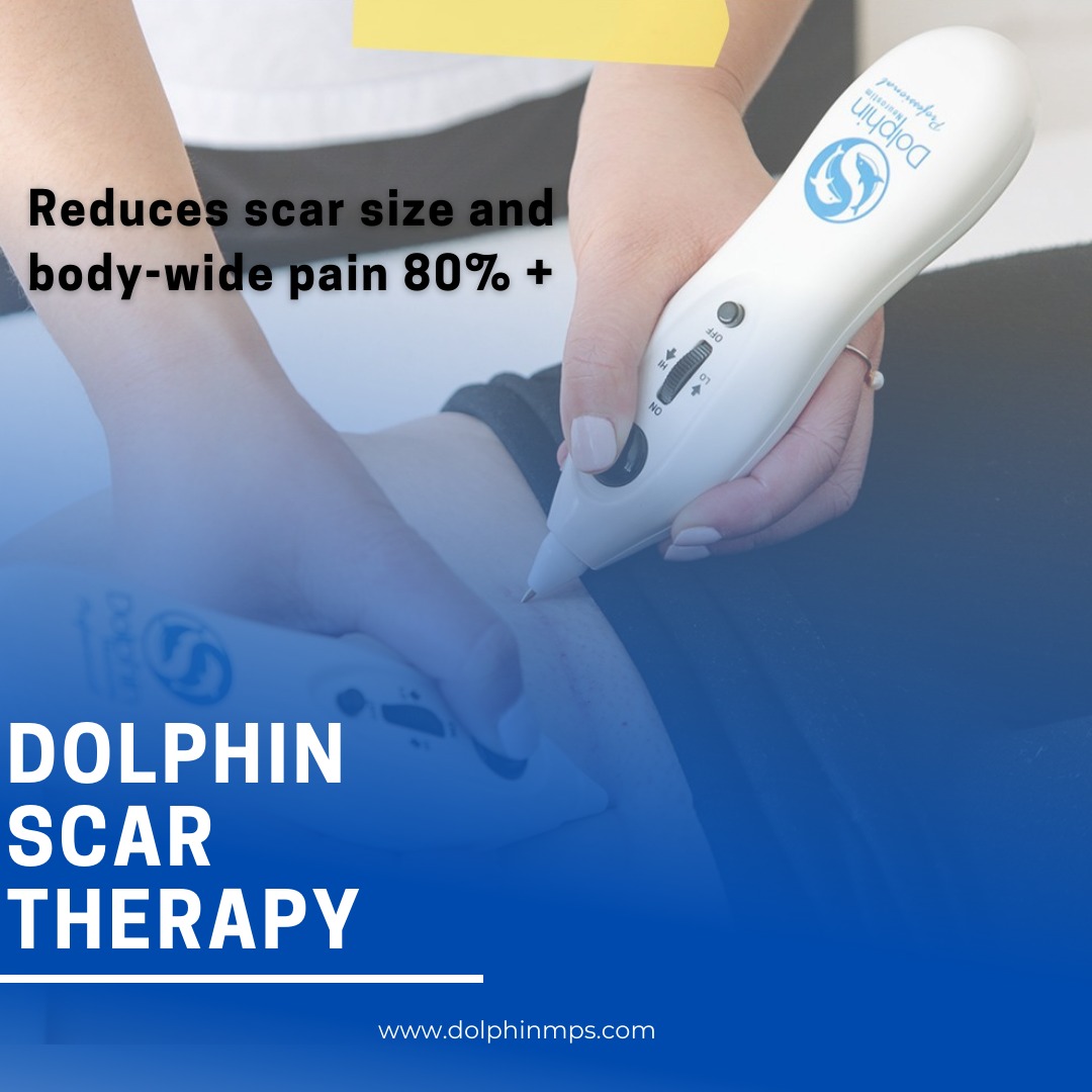 Dolphin - Scar Release Therapy (SRT) is a new therapy technique that ...