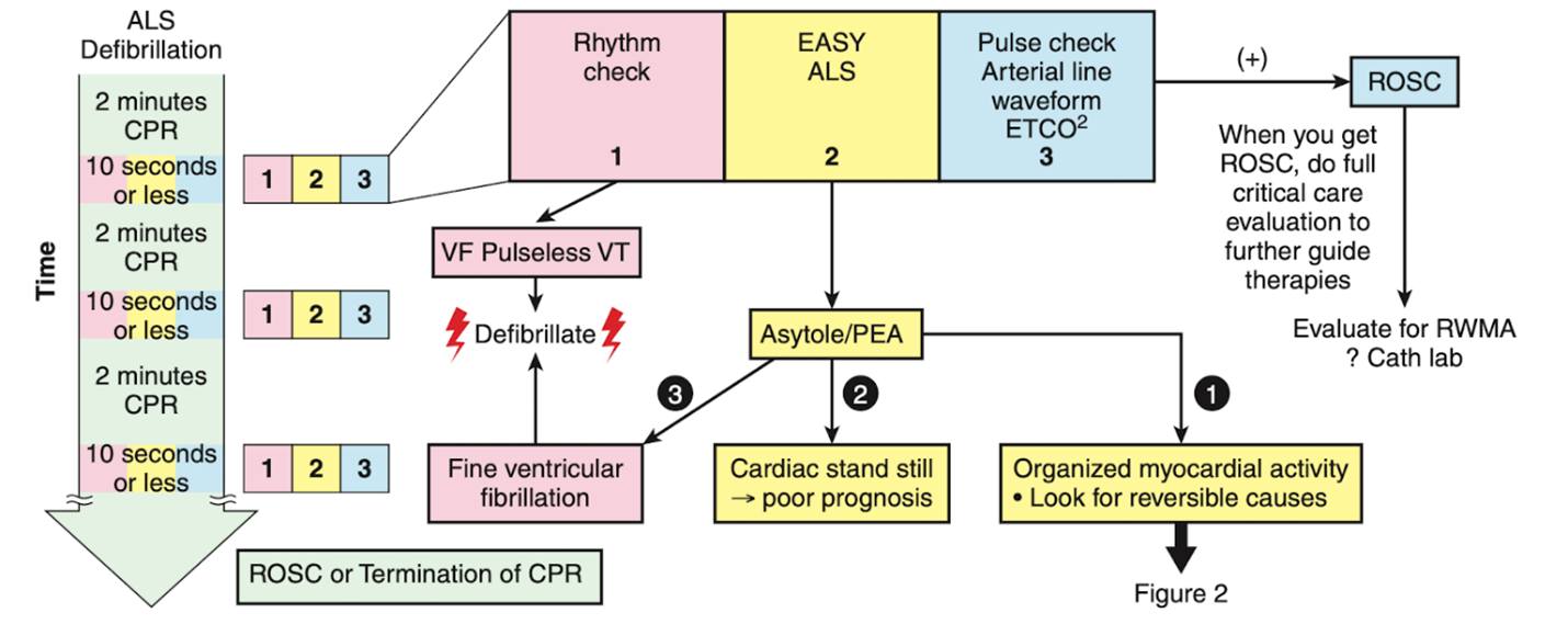 🟪 POCUS in Cardiac Arrest: The Essentials for Effective Use in ...