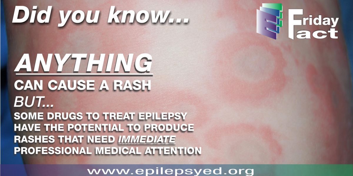 Just about anything can... - Epilepsy Education Everywhere | Facebook