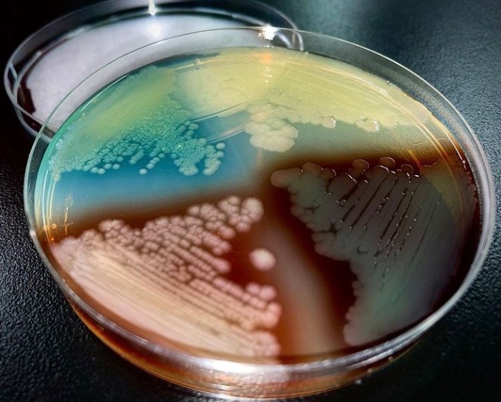 Pseudomonas aeruginosa... (Pyocyanine🟢,... - Elmicrobiologist