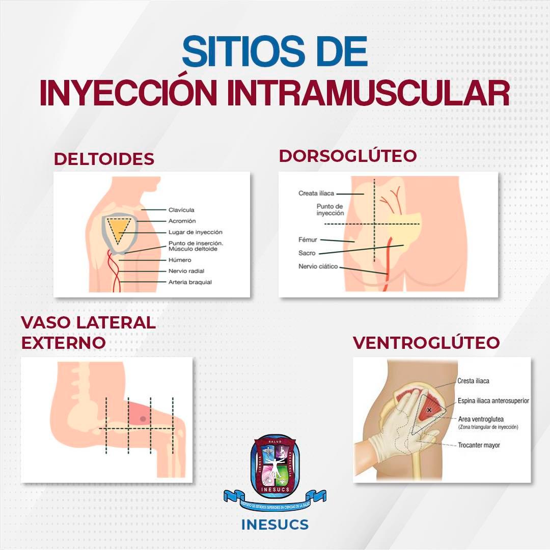 Inesucs Orizaba - 🤓 ¿Sabes cuales son los sitios de inyección ...