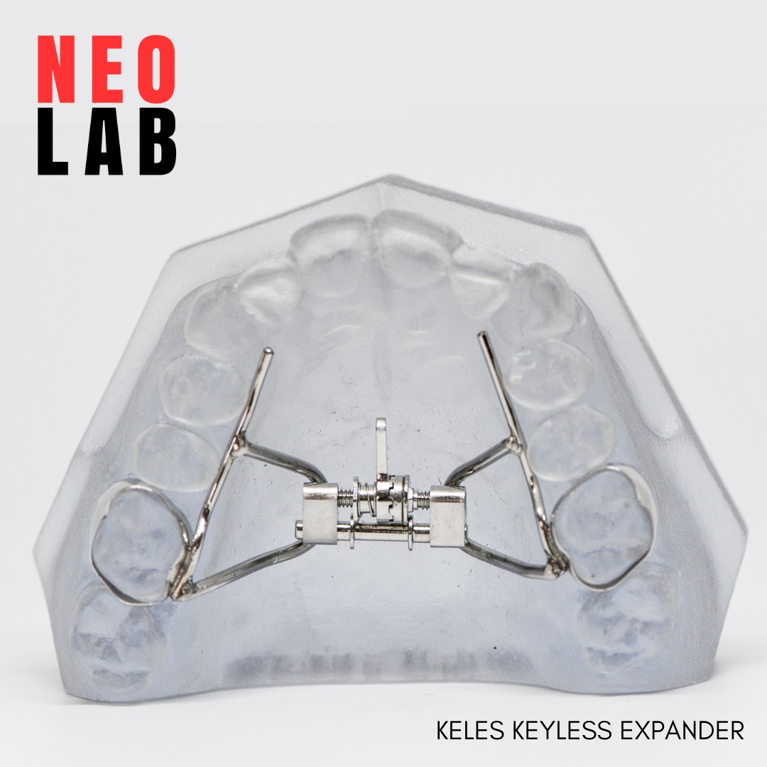 NEOLab - One of the hardest parts of expander activation is keeping ...