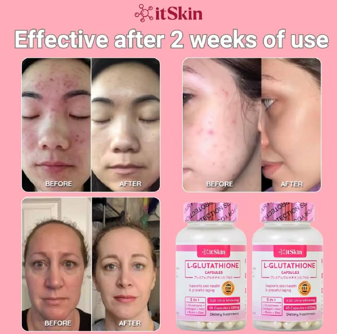 itskin glutathione collagen review 🔥 INTRODUCING ‼️ L-Glutathione Capsules With Whitens Skin Anti-Aging 60 Capsules.🩷 BD 6.500 WhatsApp 3644 1566 A sweet healing scent GHK-Cu Copper Peptide Troche, holista supplements No. of Bottles:6 Bottles (One-Time)