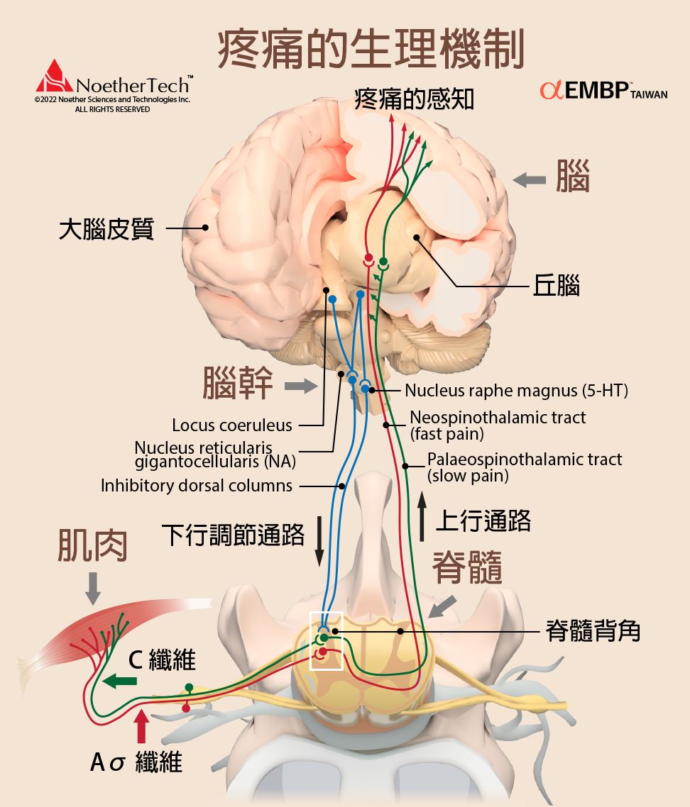 EMBP 電磁腦脈衝 | EMBP™ 有效治療軀體的 (somatic) 和心理的 (psychogenic) 疼痛 | Facebook