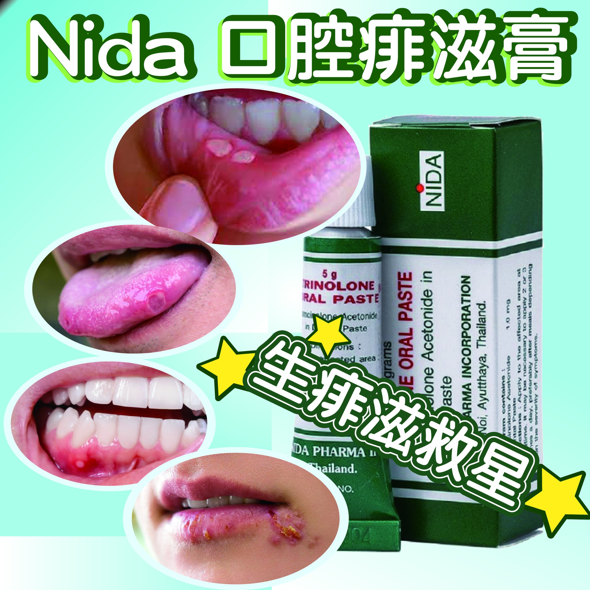 泰霸網購 - NP24062# Nida 口腔痱滋膏 5g 泰國出名有效既痱滋膏 超易用，輕輕點上就會包覆住傷患處，黏附力極強 嘴巴和口腔內 ...