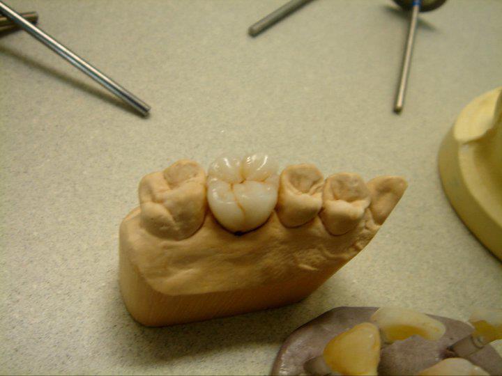 george dental lab | Aleppo