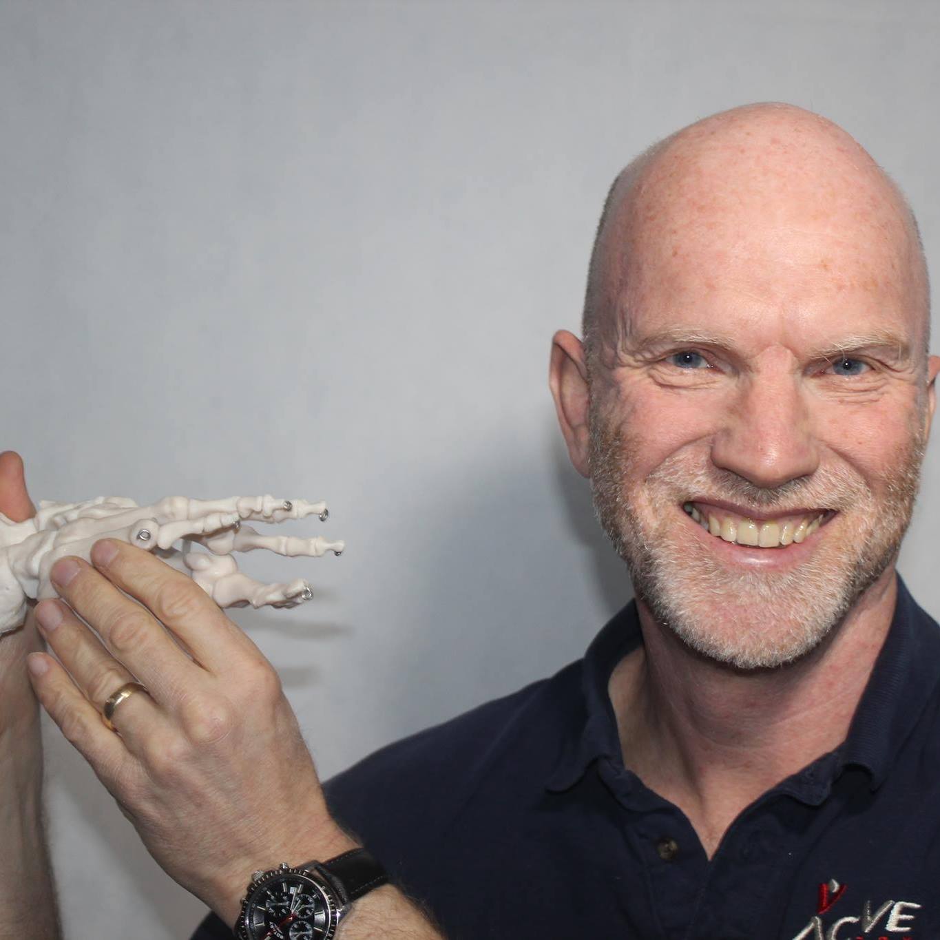 Q. How do Phits 3D Printed Orthotics ensure a perfect fit for my feet ...