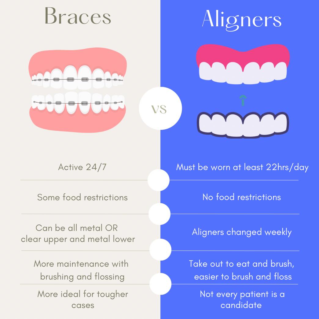 Thinking of starting orthodontic treatment but can't decide