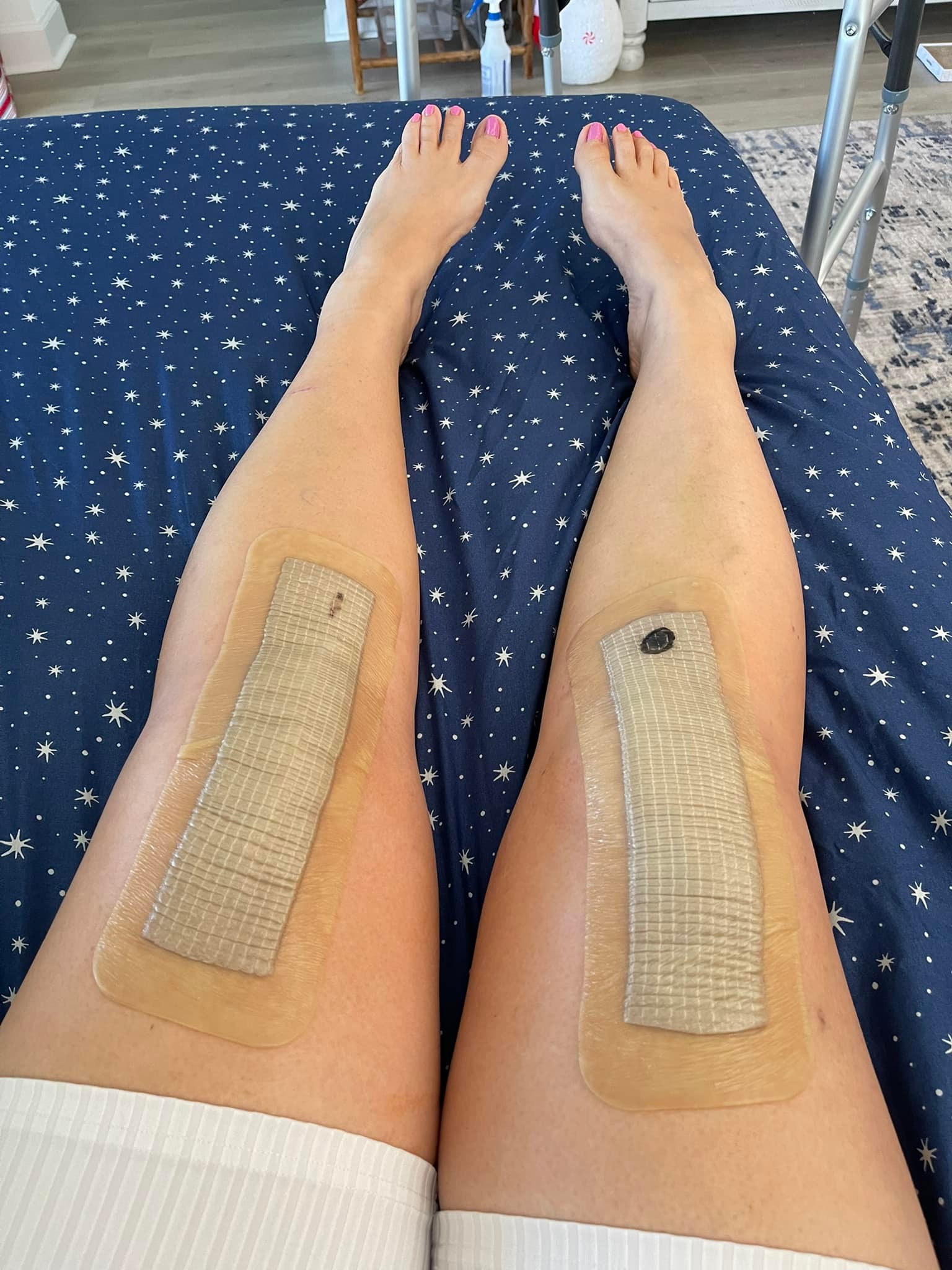 chinese dress ladies Amazon.com: 10 Pcs Waterproof Knee Replacement Dressing