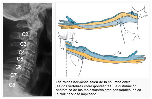 Neurocirugia León - ¿Qué es la columna cervical? La columna cervical es ...