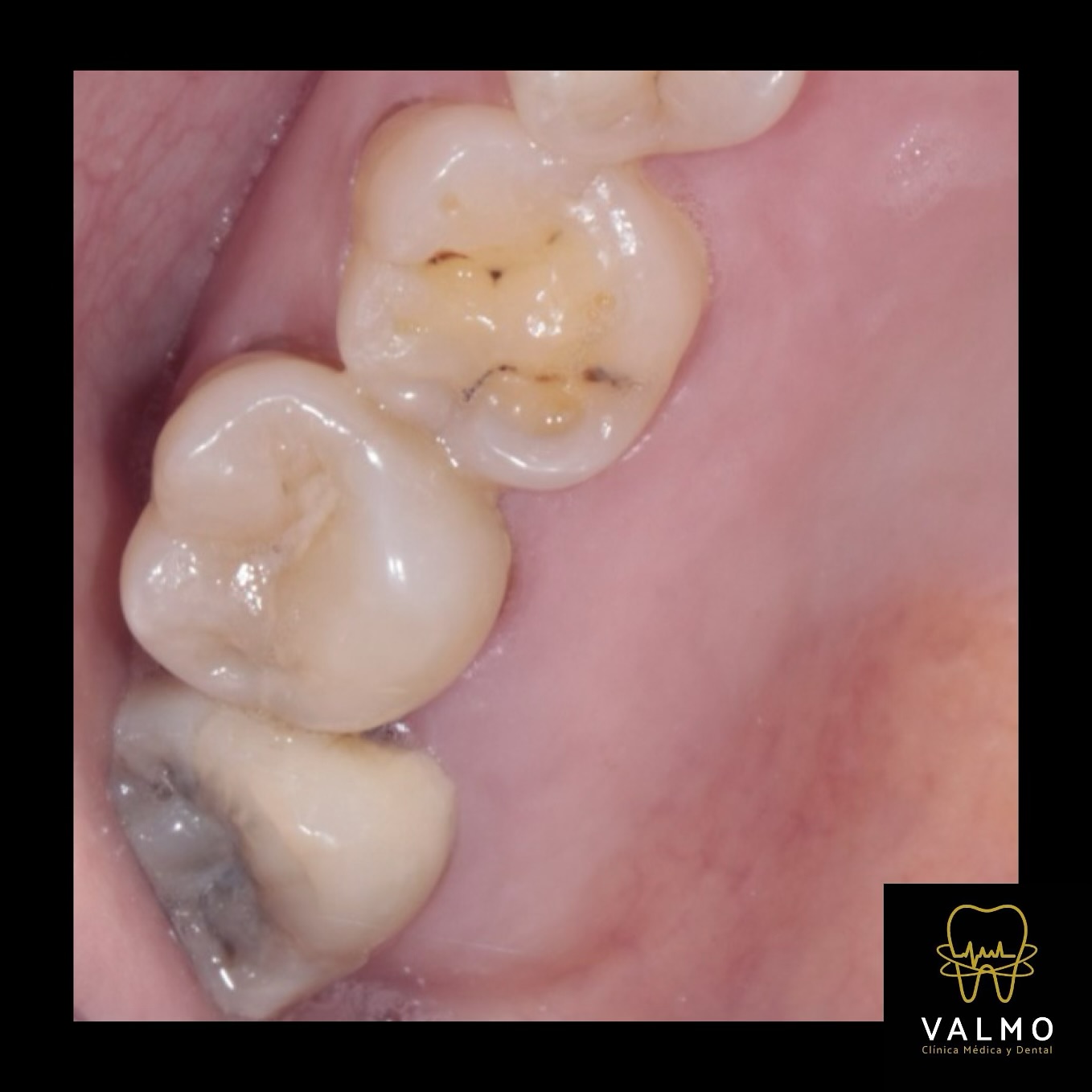 IMPORTANCIA DEL USO DEL... - VALMO Clínica médica y dental | Facebook
